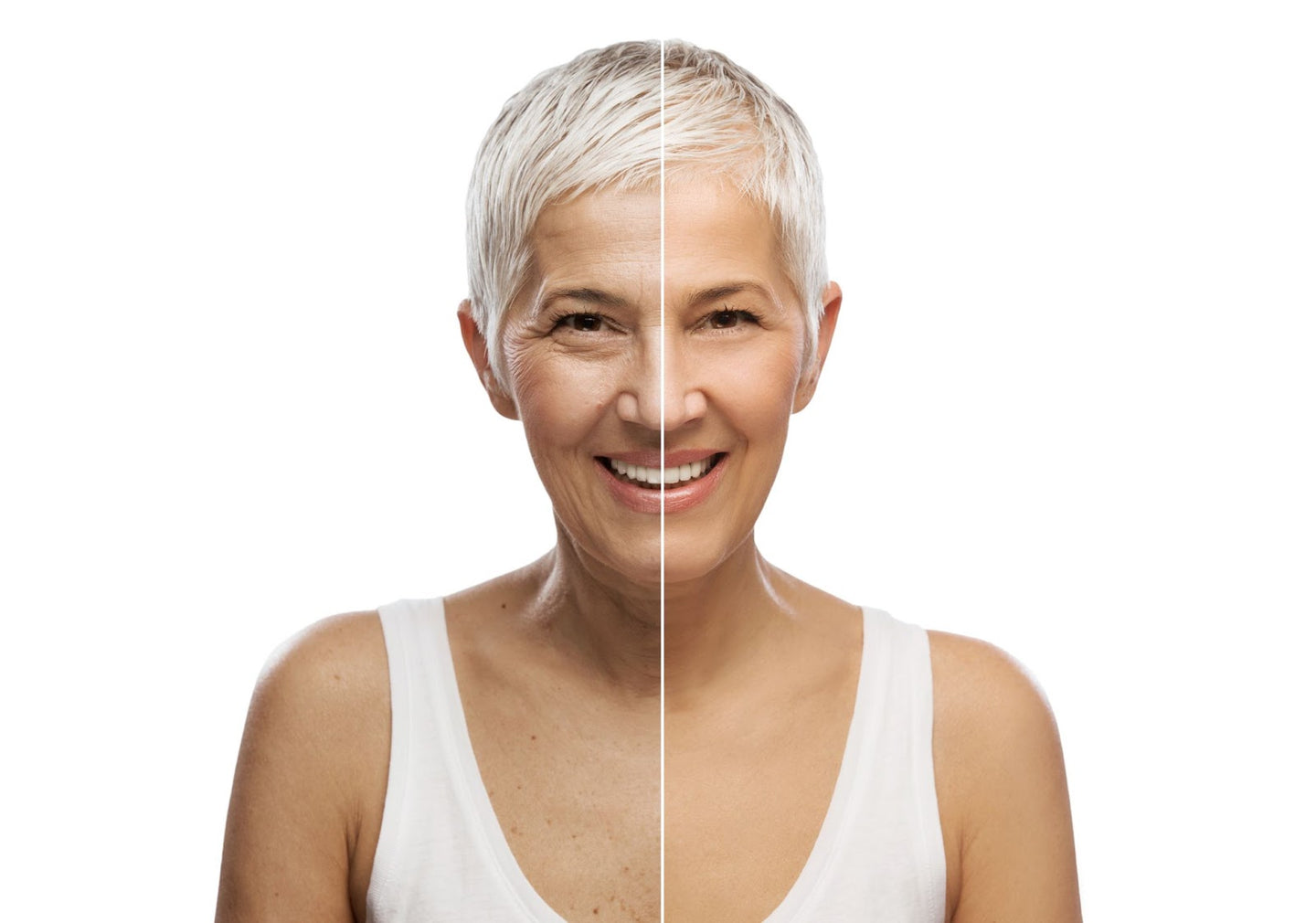How Does Cross-Linked Hyaluronic Acid Help My Skin?
