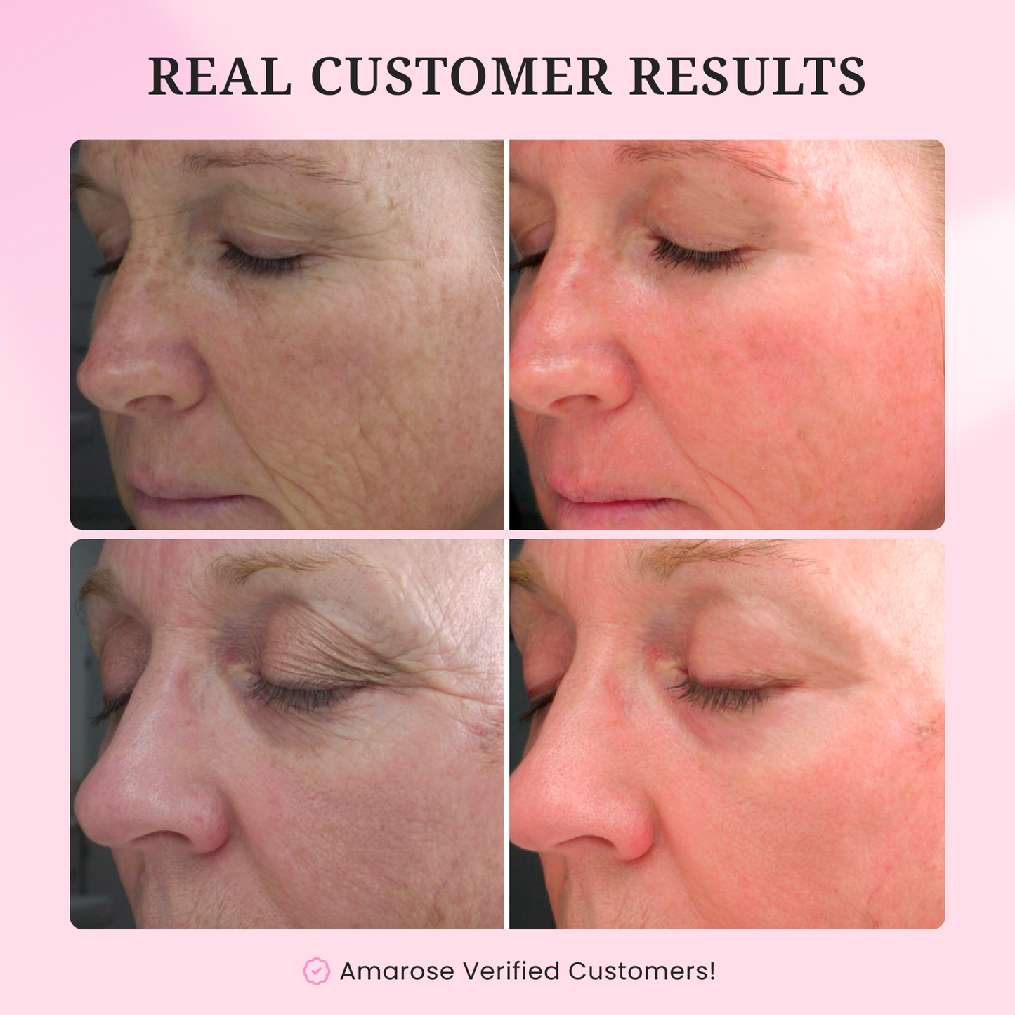 Instalift - Anti Aging Serum
