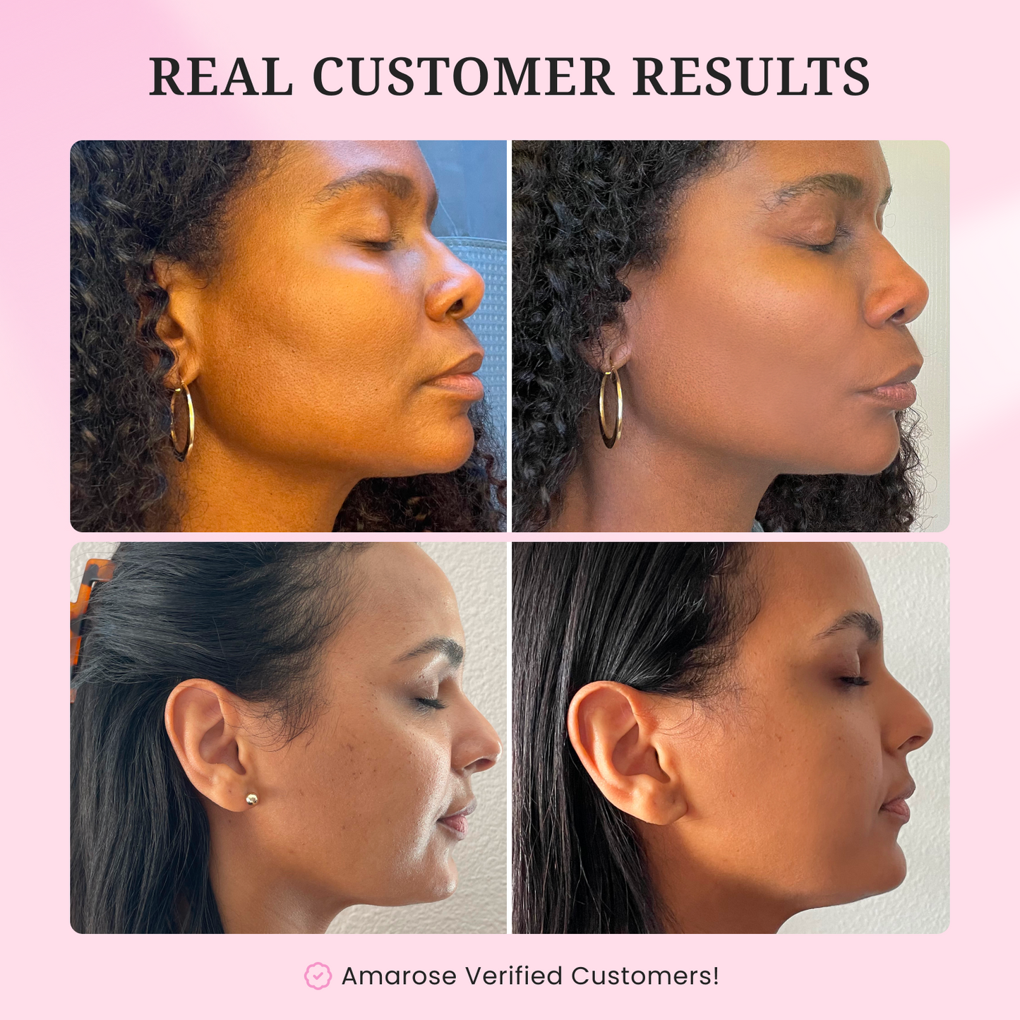 Lifting Serum