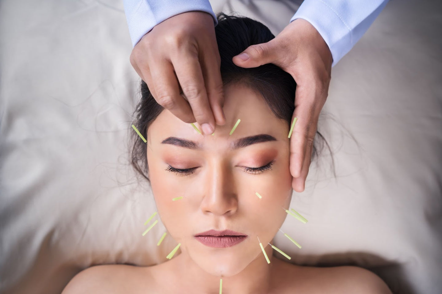 Facial Acupuncture: What Is It and What Are Its Benefits?